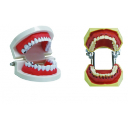 Mô hình hàm răng
